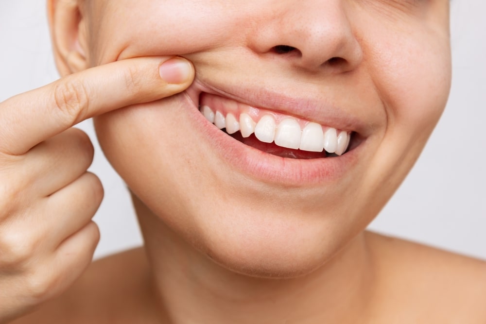 Gencive en santé Parodontie - Dentiste Laval