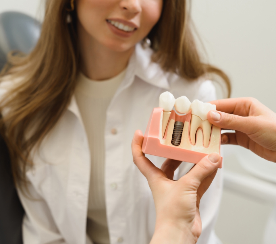 Les implants dentaires :  une solution avantageuse grâce  à l’ostéointégration