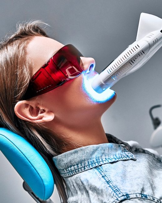Le blanchiment : pour pallier les effets du jaunissement