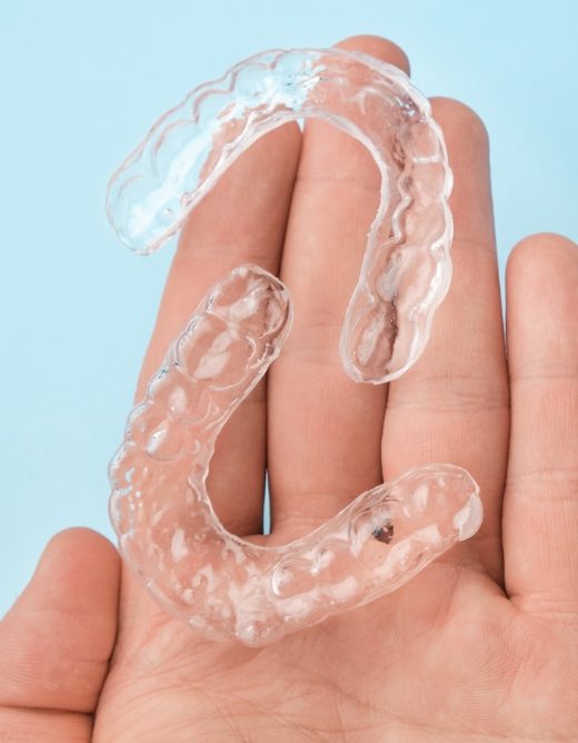 Qu’entend-on par orthodontie invisible 